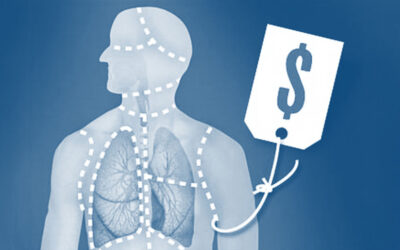 Find Me Somebody to Organ-Rob–Alive or Dead