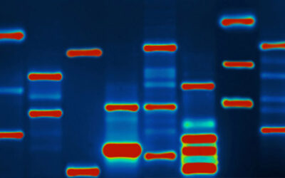 Is aborted fetal DNA linked to autism?