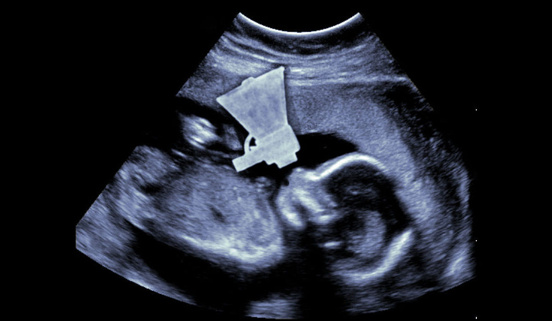 If Preborn Babies Had Voices